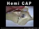 Hemi CAP