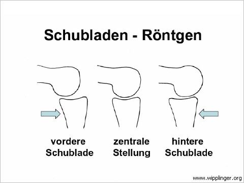 Schubladen - Röntgen